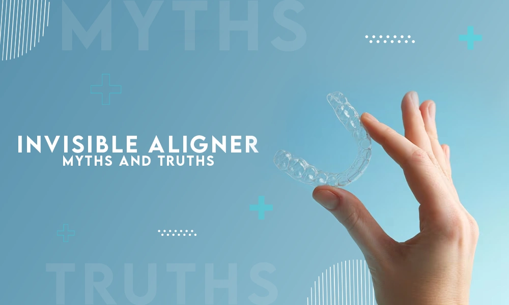 INVISIBLE ALIGNER MYTHS AND TRUTHS